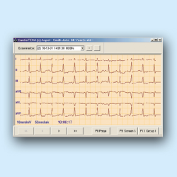 CardioTEKA - oprogramowanie EKG v.001