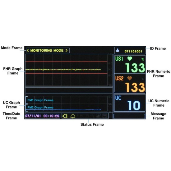 Kardiotokograf KTG Bistos BT-350 LCD